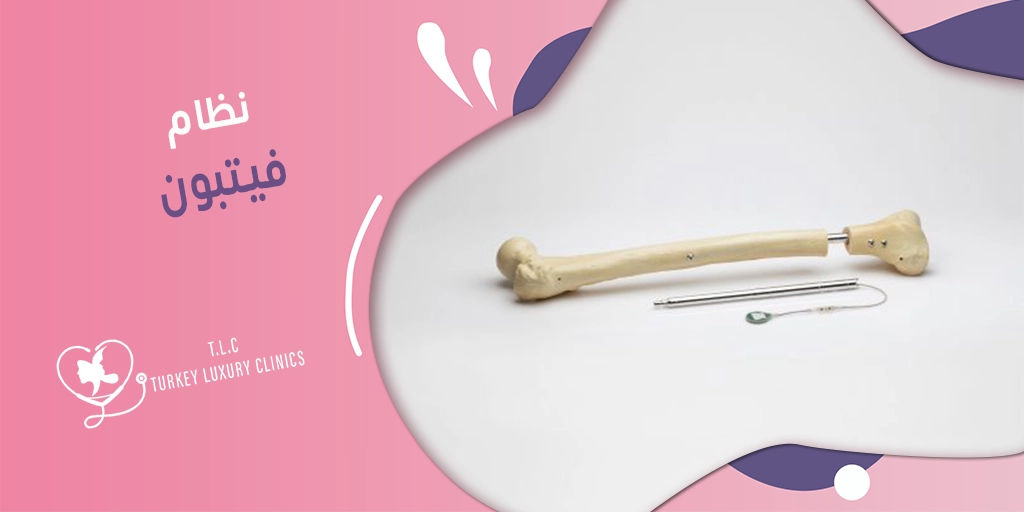 نظام فيتبون: تقنية حديثة لزيادة الطولfeatured image