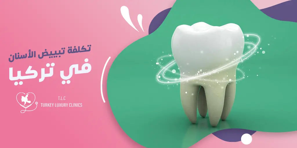 تكلفة تبييض الأسنان في تركيا