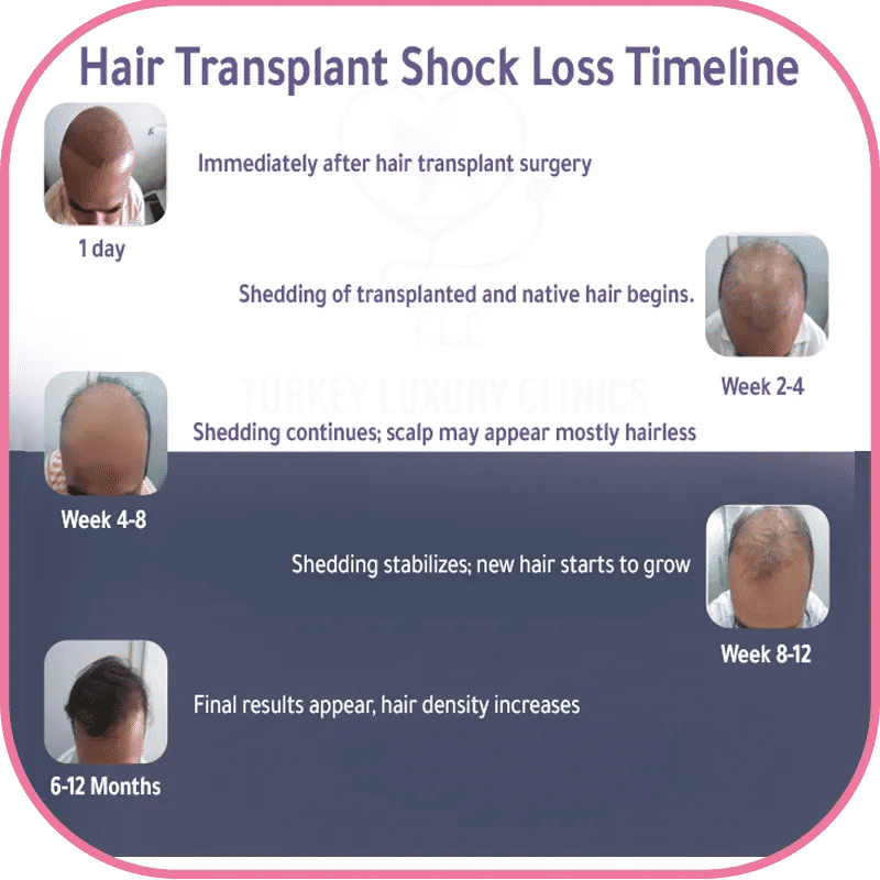 Final phase of shock loss: week 8 to 12