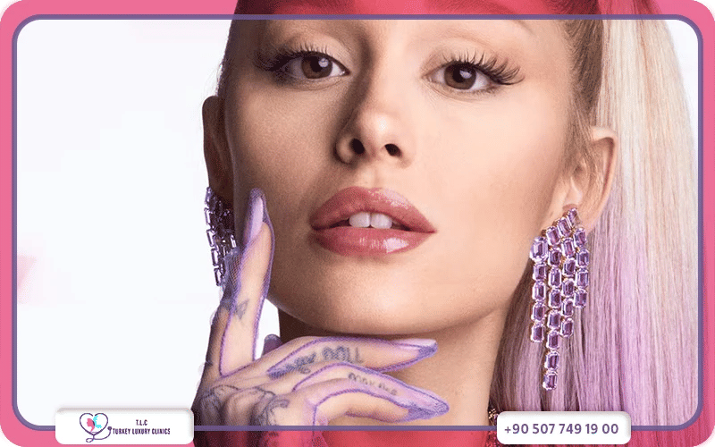 ابتسامة هوليود أسنان الأرنب ابتسامة هوليود أسنان الأرنب