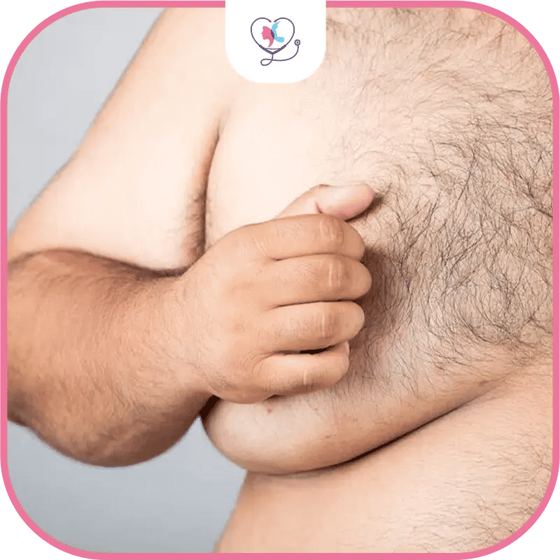 ما هو تجمع السوائل بعد عملية التثدي؟