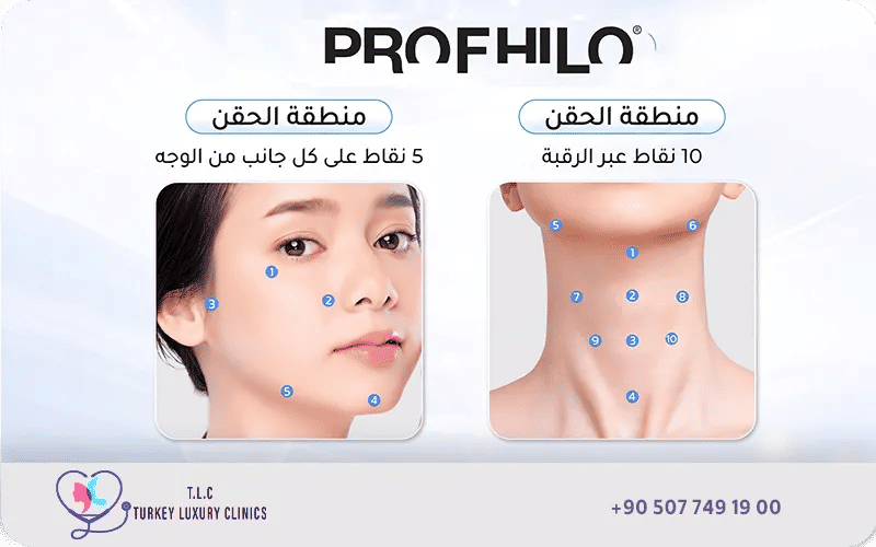 أماكن حقن البروفايلو في الوجه بالتفصيل