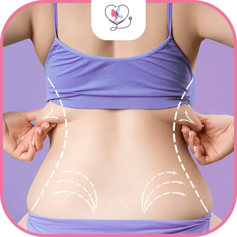 تقنيات الشفط المستخدمة في عملية شد الظهر