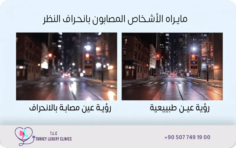أعراض انحراف النظر