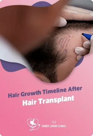 Hair Growth Timeline After Hair Transplant