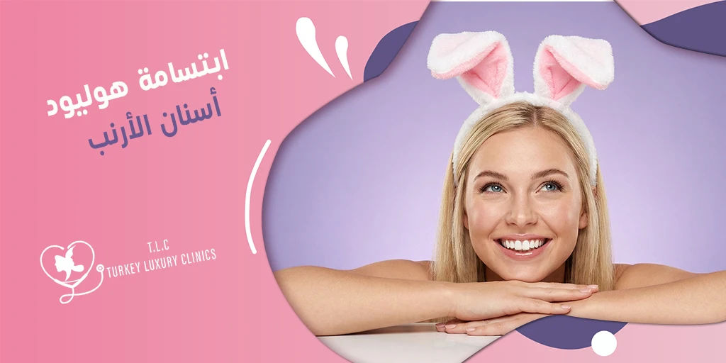 ابتسامة هوليود أسنان الأرنب: مميزات وعيوب ونتائج بالصور