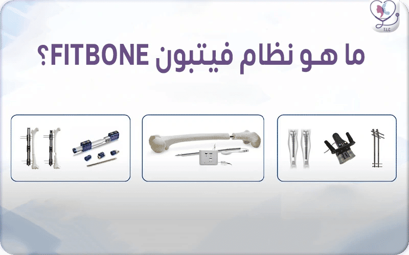 ما هو نظام فيتبون FITBONE؟