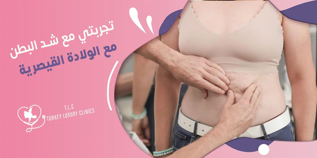 تجربتي مع شد البطن مع الولادة القيصرية: هل هذا ممكن؟