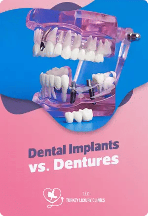 Dental Implants vs. Dentures: Weighing the Pros and Cons to Make the Right Choice