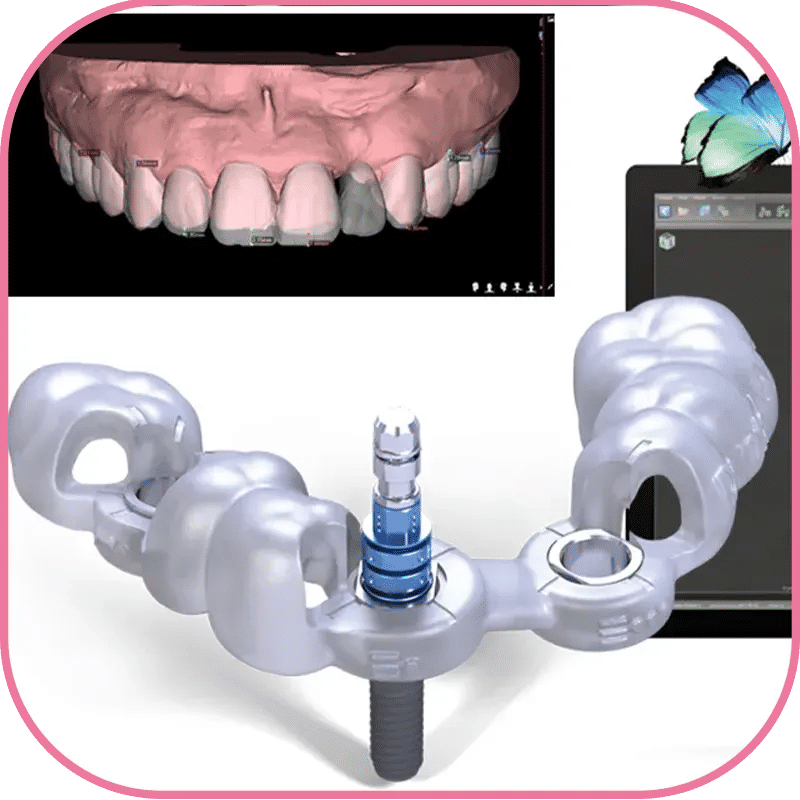 3D Printed Dental Implants Images des