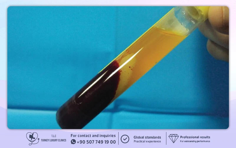 Centrifugation