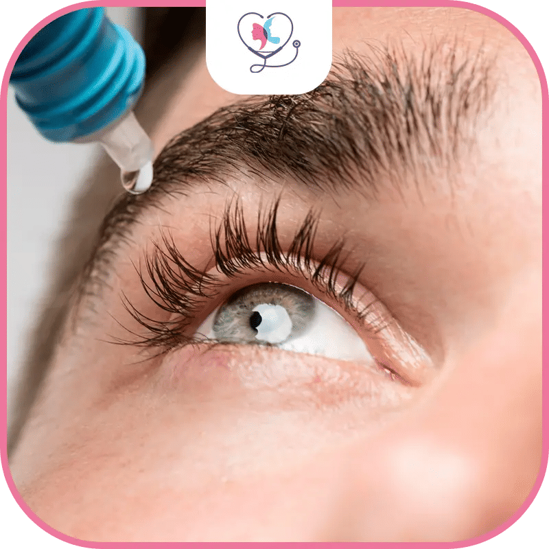 حساسية العين