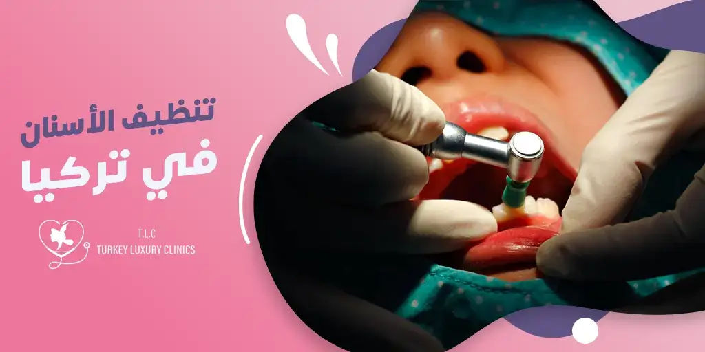 تنظيف الأسنان في تركيا