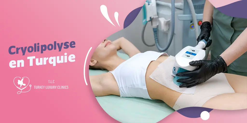 Cryolipolyse en Turquie : La révolution de la silhouette