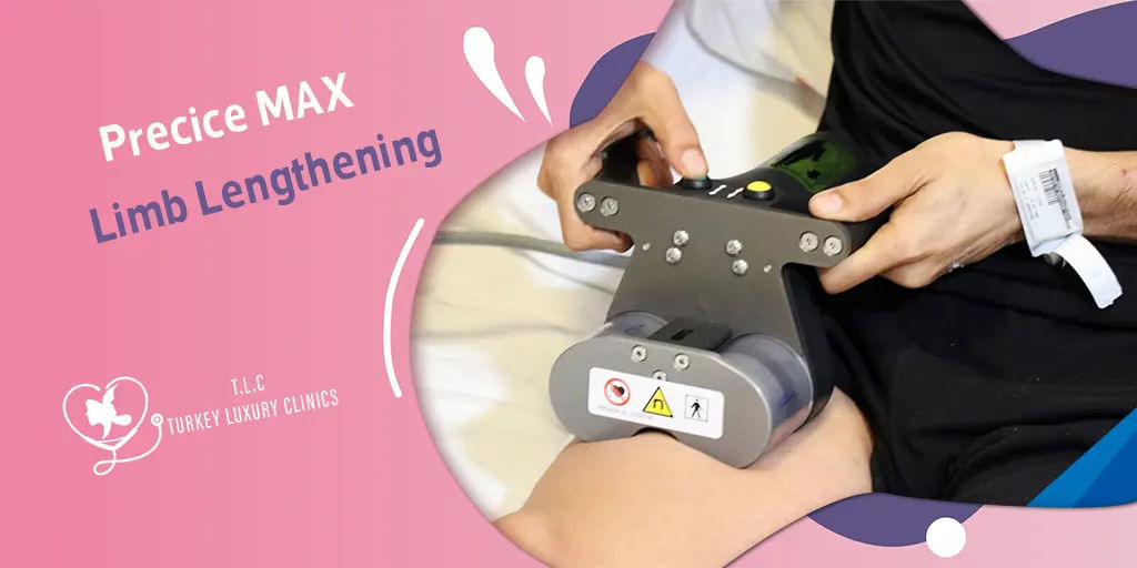 Precice MAX Limb Lengthening: Cost, Advantages & Recall
