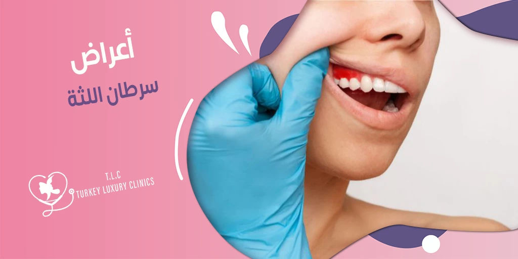 أعراض سرطان اللثة: العلاج مع الصور والأسعار