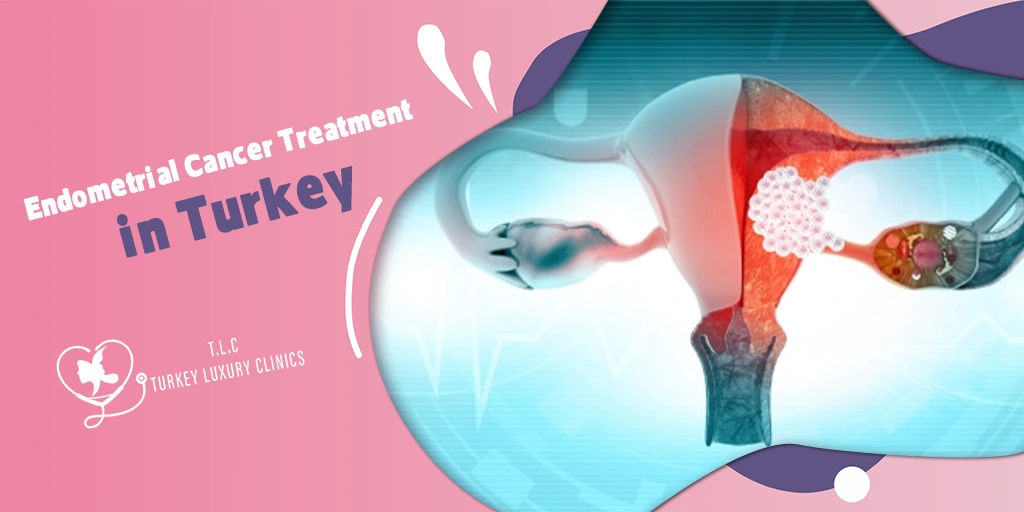 Endometrial Cancer Treatment in Turkey: 2026 Prices,Treatments & Success Rate