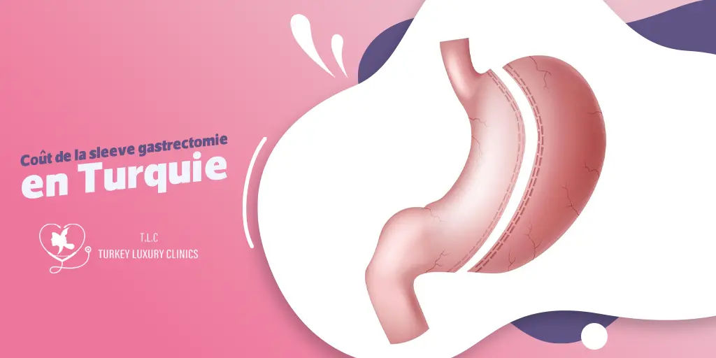 Coût de la sleeve gastrectomie en Turquie