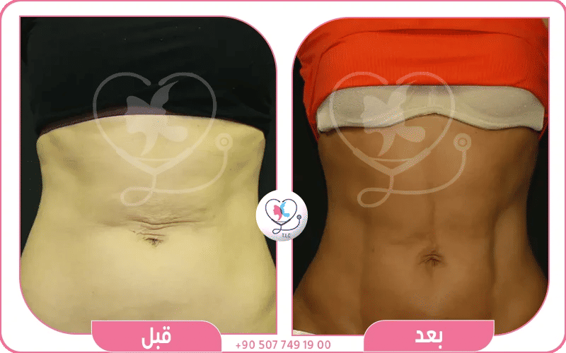 الاستعداد النفسي وتوقع النتائج