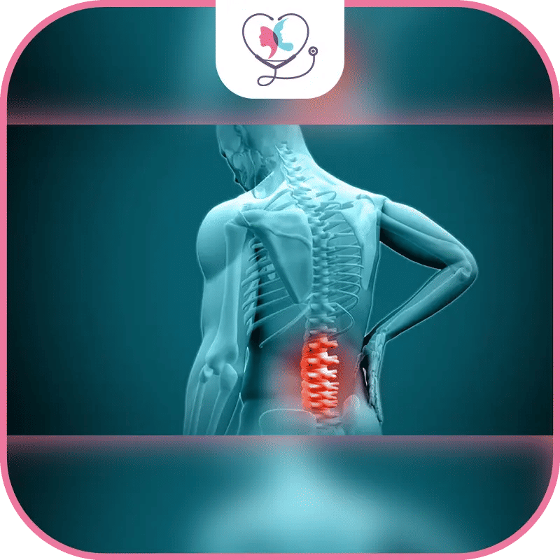 الانزلاق الغضروفي