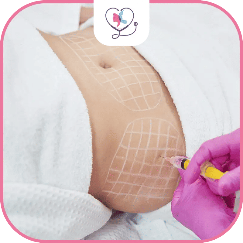 Qu'est-ce que l'intralipothérapie ?