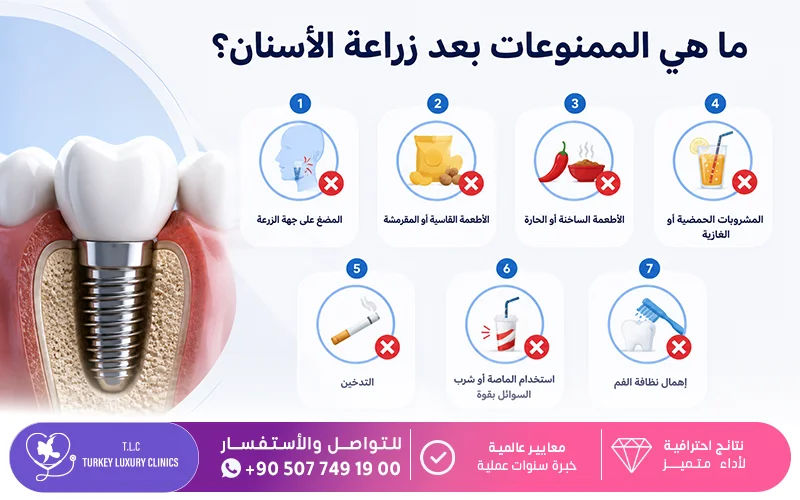 ما هي الممنوعات بعد زراعة الأسنان؟