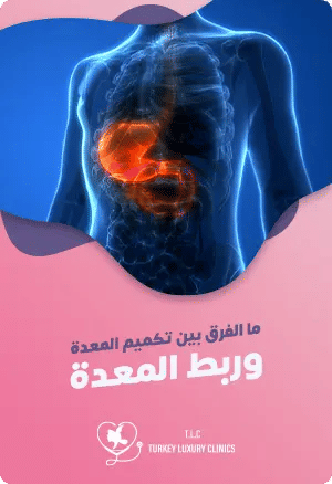 ما الفرق بين تكميم المعدة وربط المعدة؟featured image