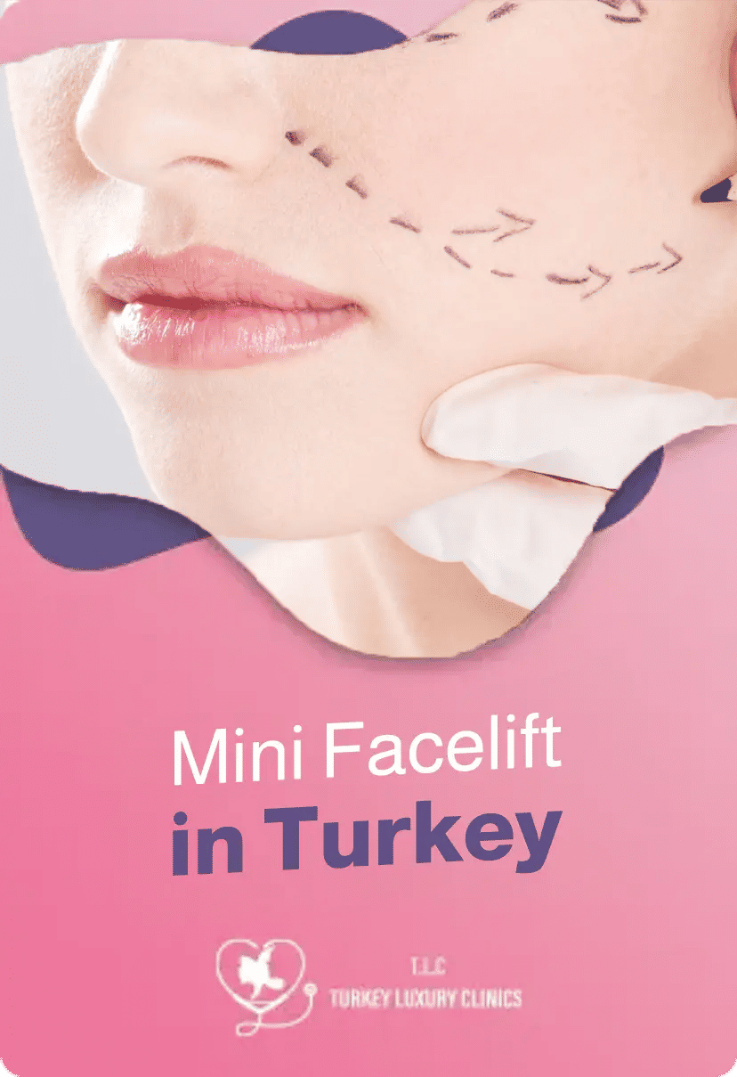 Mini Facelift in Turkey: Prices, Packages & Real Reviews 2026