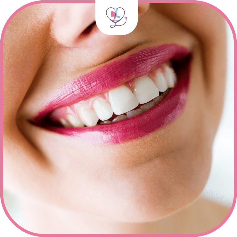 أضرار ابتسامة هوليود