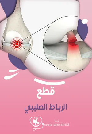 قطع الرباط الصليبي: الأعراض والعلاج جراحياً وبدون جراحة