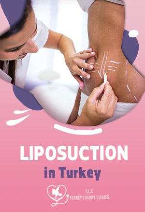 Liposuction in Turkey: Cost, Before & After, Packages and Clinics (2026)