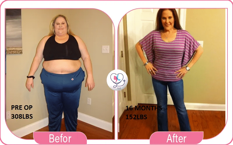 أولاً: اهتمام الفريق بي