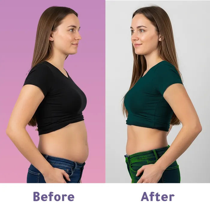 نتيجة عملية شد البطن في تركيا - تحول مذهل من ترهلات ما بعد التكميم إلى بطن مشدود وملامح أنثوية متناسقة