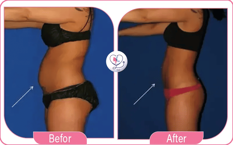 سادساً: لا تناسب أصحاب الوزن الكبير