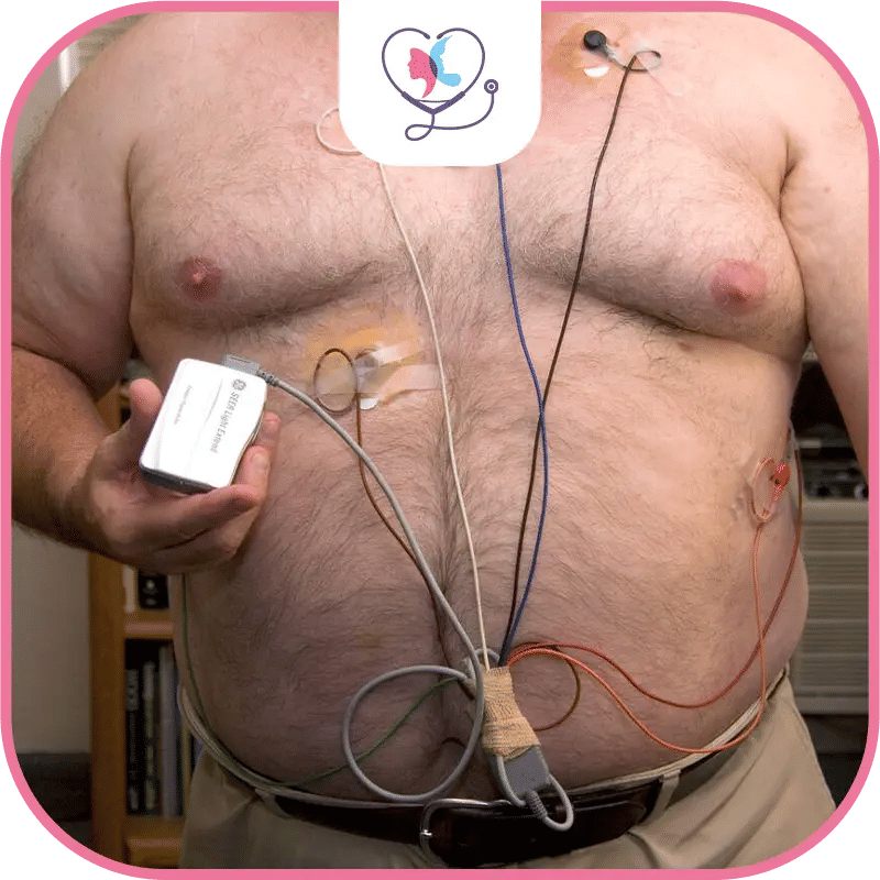 Quand peut-on faire une sleeve