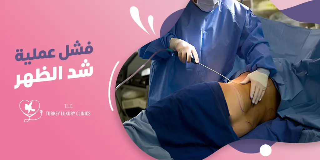 فشل عملية شد الظهر