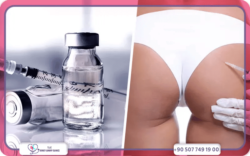 تجربتي مع فيلر المؤخرة