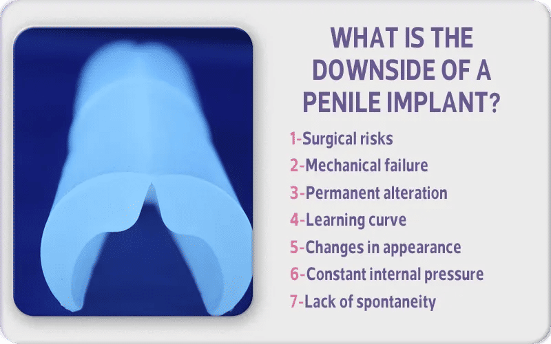 What is the Downside of a Penile Implant?