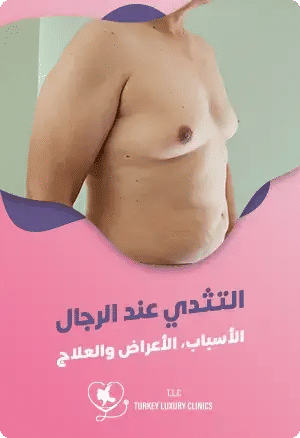 التثدي عند الرجال: الأسباب، الأعراض والعلاجfeatured image