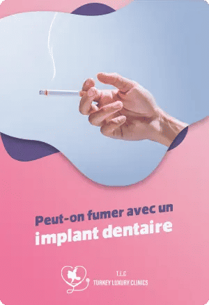 Peut-on fumer avec un implant dentaire