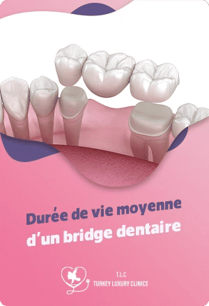 Durée de vie moyenne d'un bridge dentaire