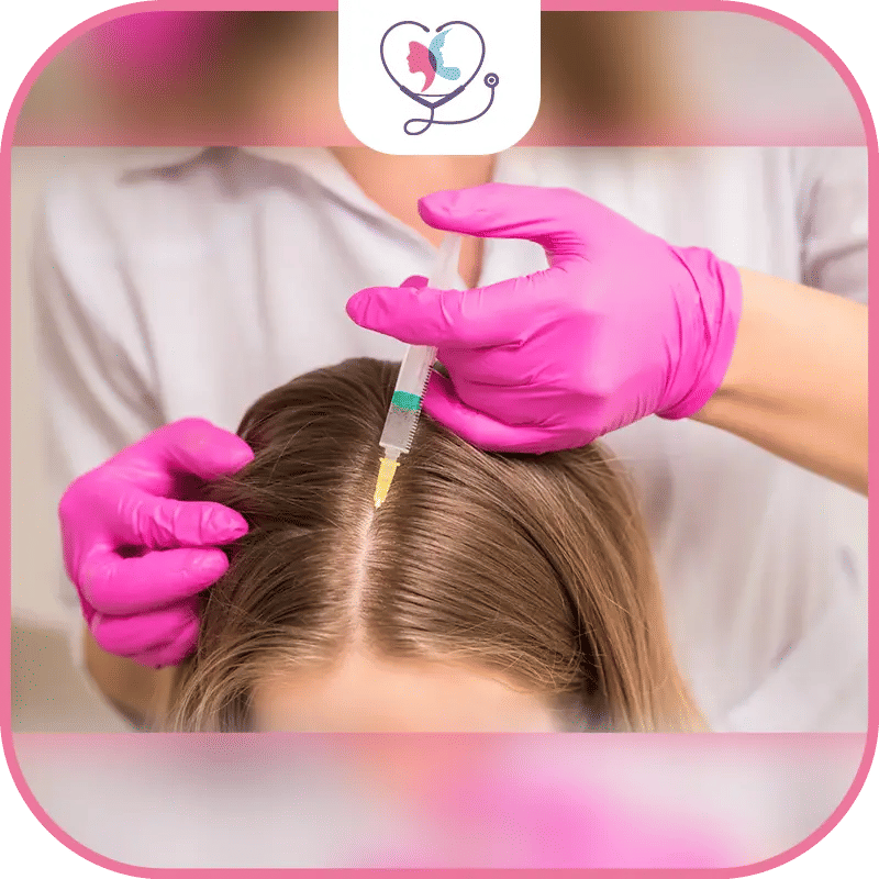 ما هو فيلر الشعر؟