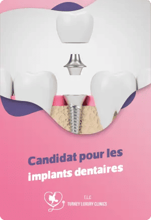 Candidat pour les implants dentaires