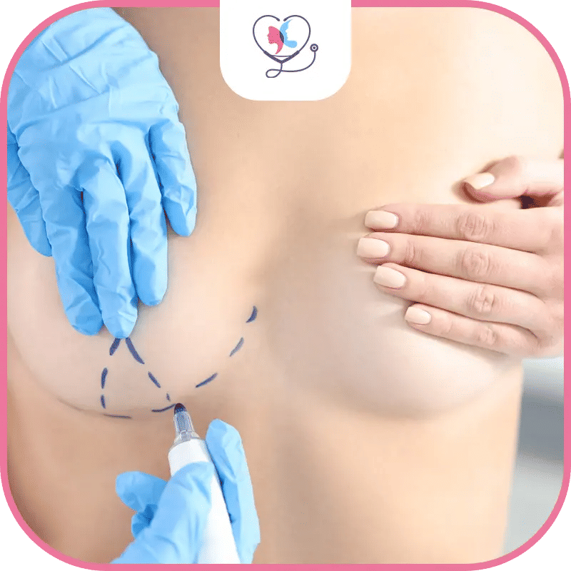 تكلفة عملية تكبير الثدي في تركيا