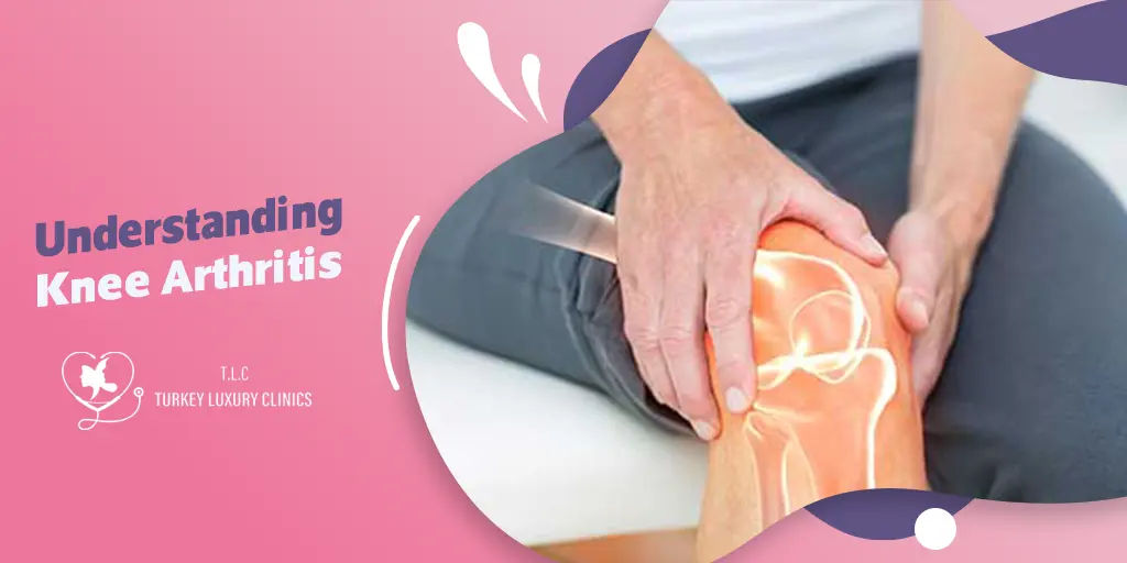 Understanding Knee Arthritis