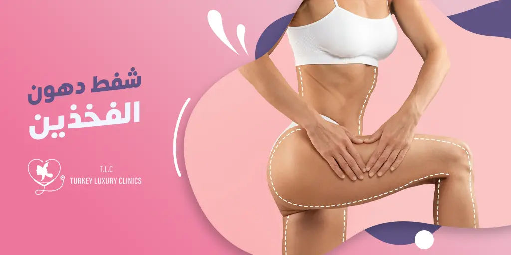 شفط دهون الفخذين