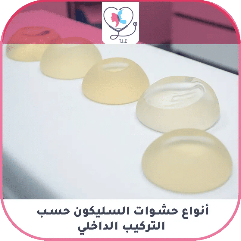 ثالثاً: أنواع الحشوات حسب منشأ التصنيع