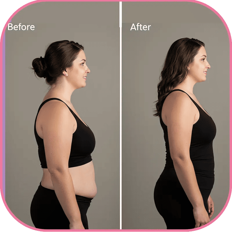 Reasons for Gastric Sleeve to Bypass Conversion