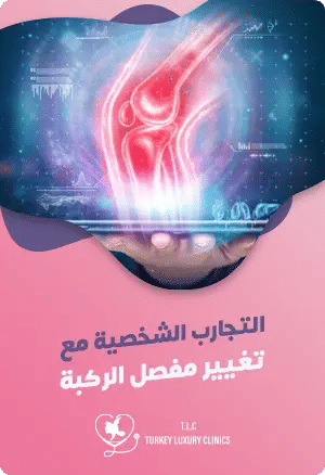 تجربتي مع عملية تغيير مفصل الركبةfeatured image