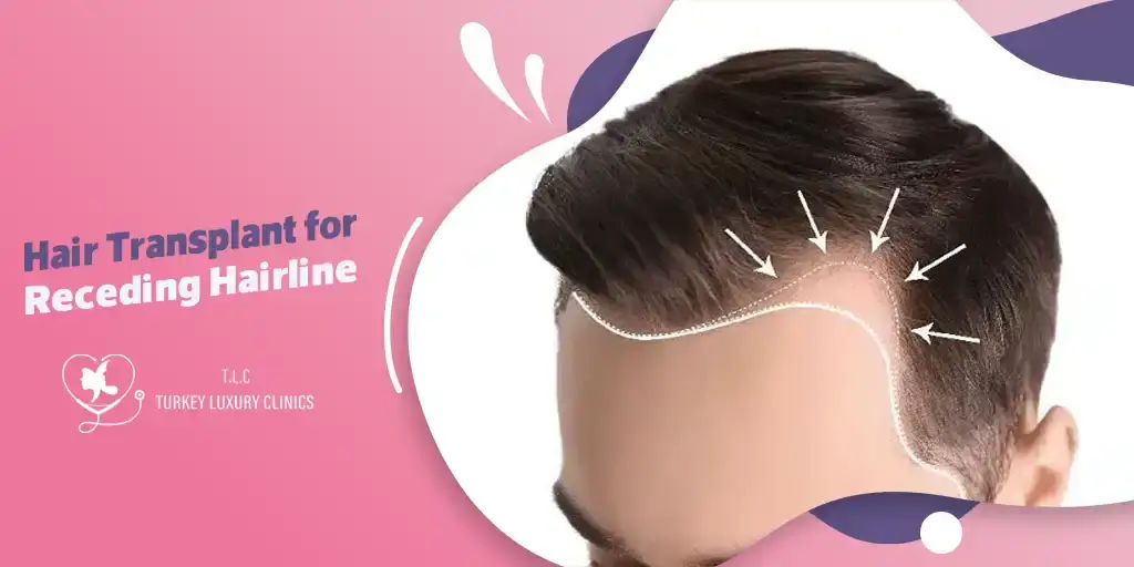 Hair Transplant for Receding Hairline: Restore Your Hair Naturally